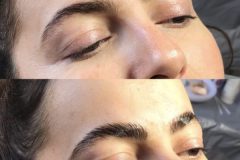 Brow-Lamination-client-05
