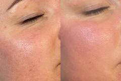 03-micro-pores
