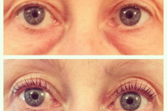 lashlift3