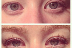 lashlift2