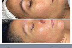 03 bt-beforeandafter-all-rev0807233-1717610299-6660a73bea622