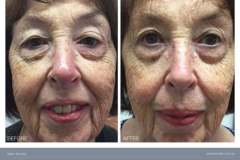 01 bt-beforeandafter-all-rev0807237-1717610305-6660a741eddff