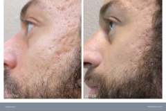 02 bt-beforeandafter-all-rev0807239-1717610312-6660a7486069a